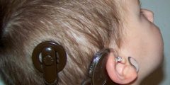 ما هي زراعة قوقعة الأذن